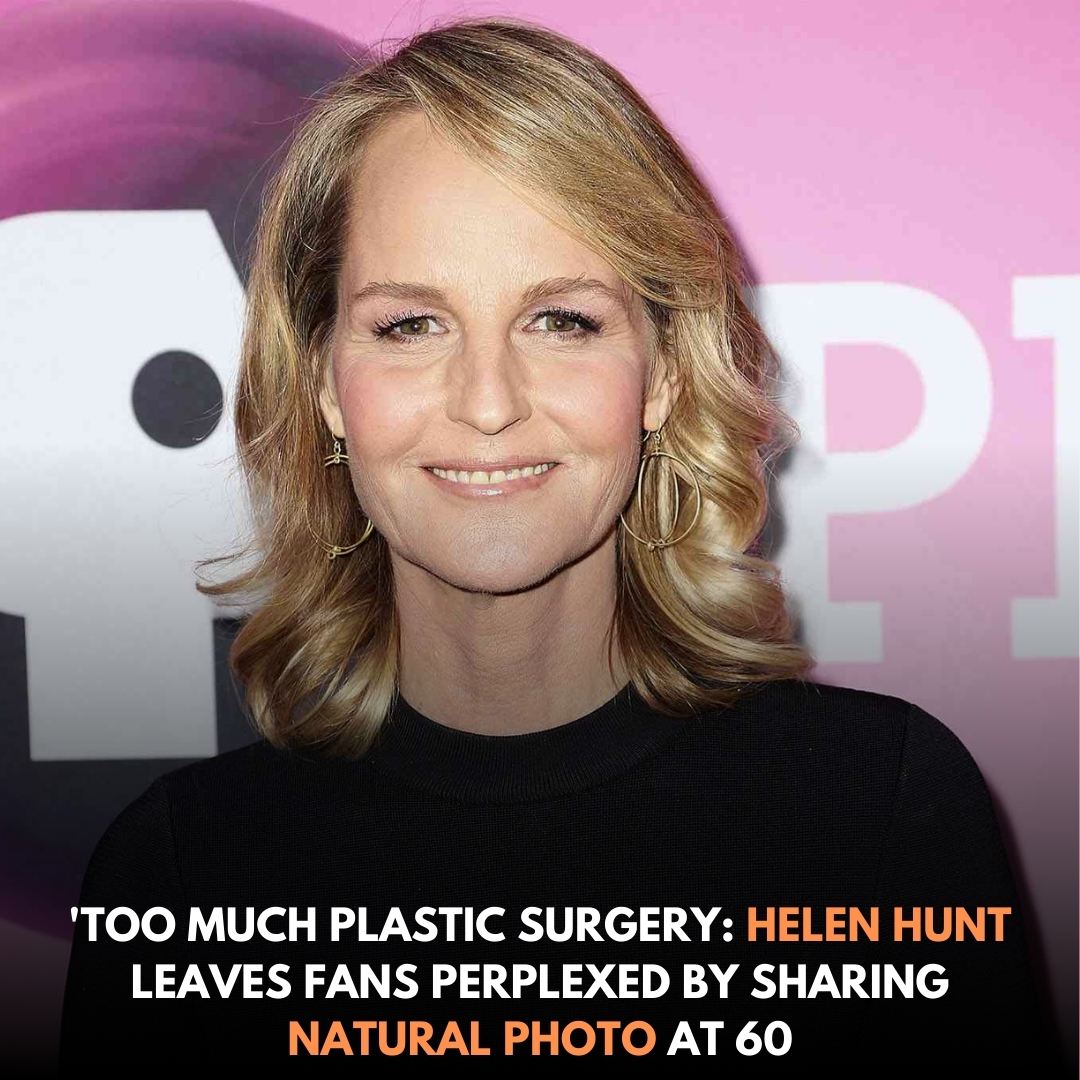 The 60-year-old actress faced significant backlash over her natural ...